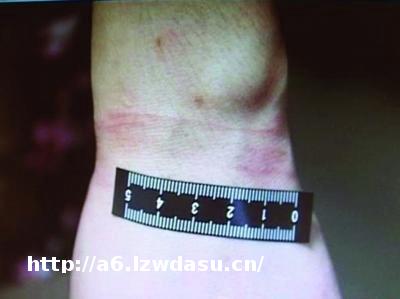 女子和男网友玩“捆绑游戏” 被绑折磨14个小时(图)